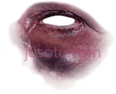 眼圈擦伤PNG